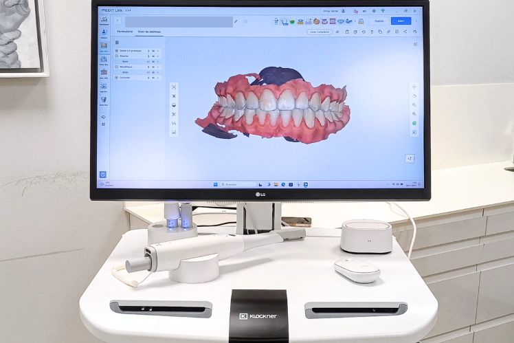 Escaner Intraoral Medit i700w
