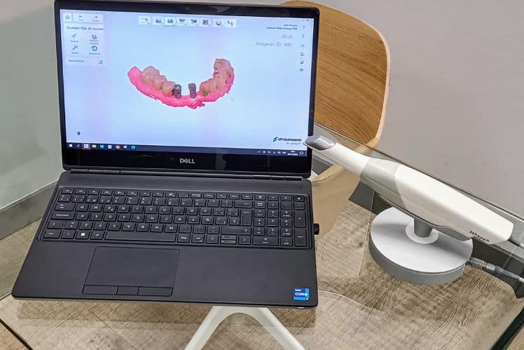 Escáner intraoral - Trios 3Shape