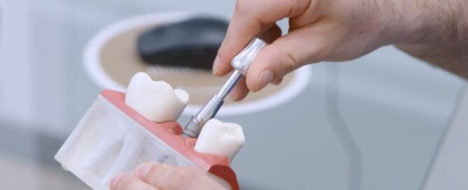 Implante dental post extracción