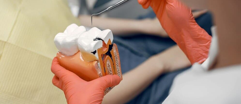 Qué es la endodoncia