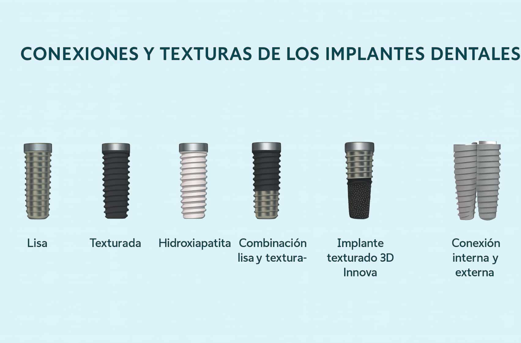 Conexiones y texturas según implante dental